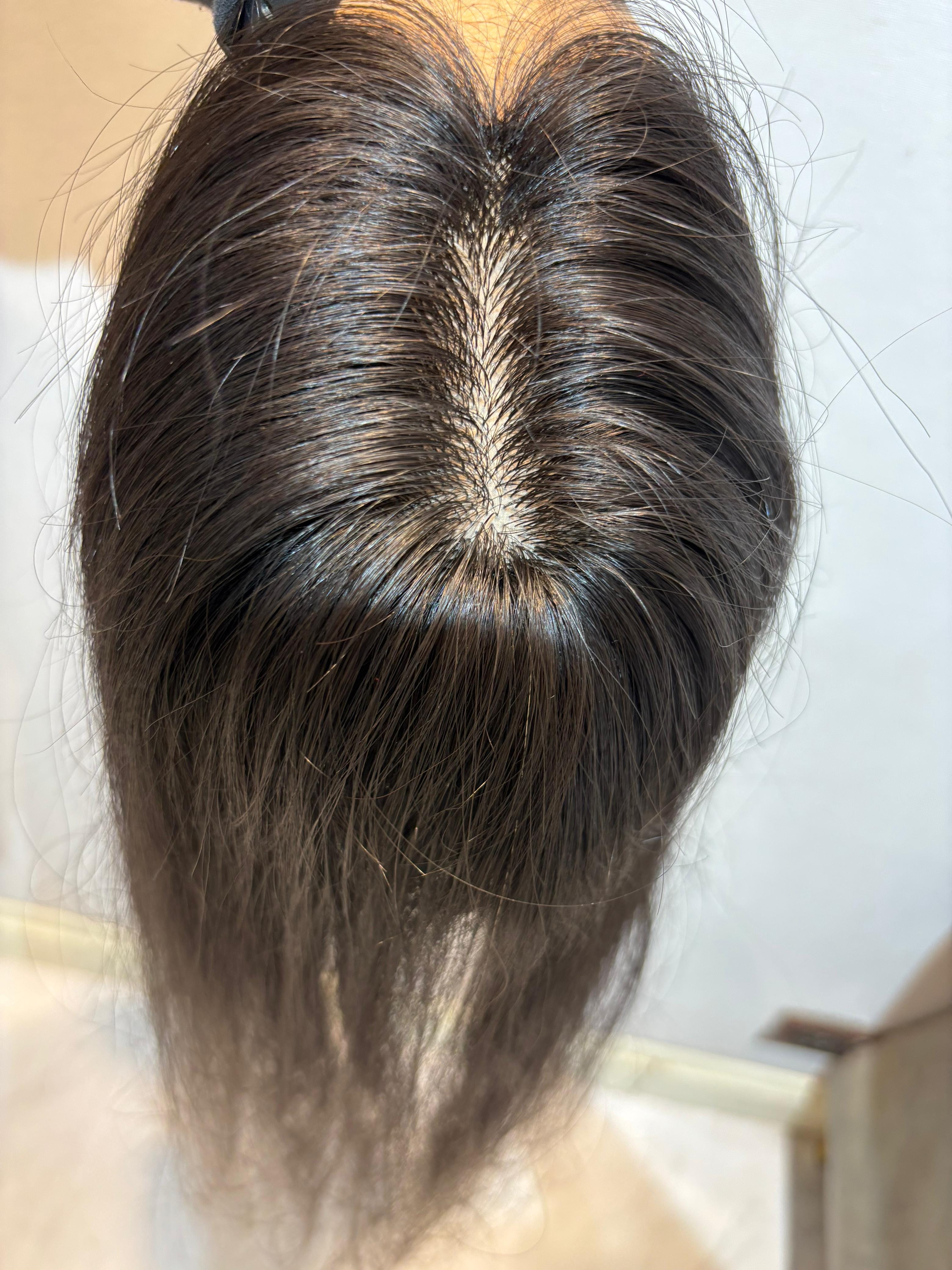 Hair Patch for Bald Spots | Silk Base | Natural Black | Straight | Remy Hair India-1